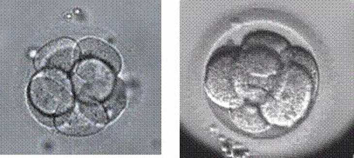 女性不孕症[广州世纪助孕]+试管婴儿胚胎选哪种好？该怎么选择？